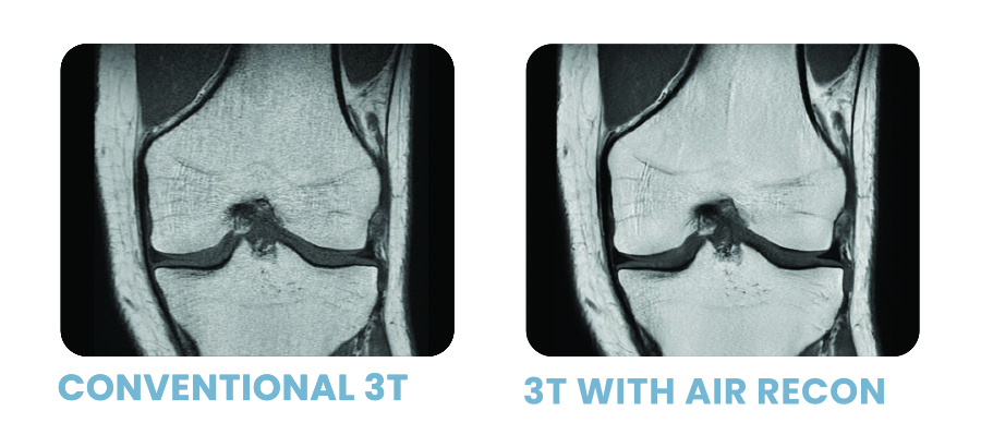 Artificial Intelligence For Mri Shields - Download Elegant Mountain Picture | 8K
